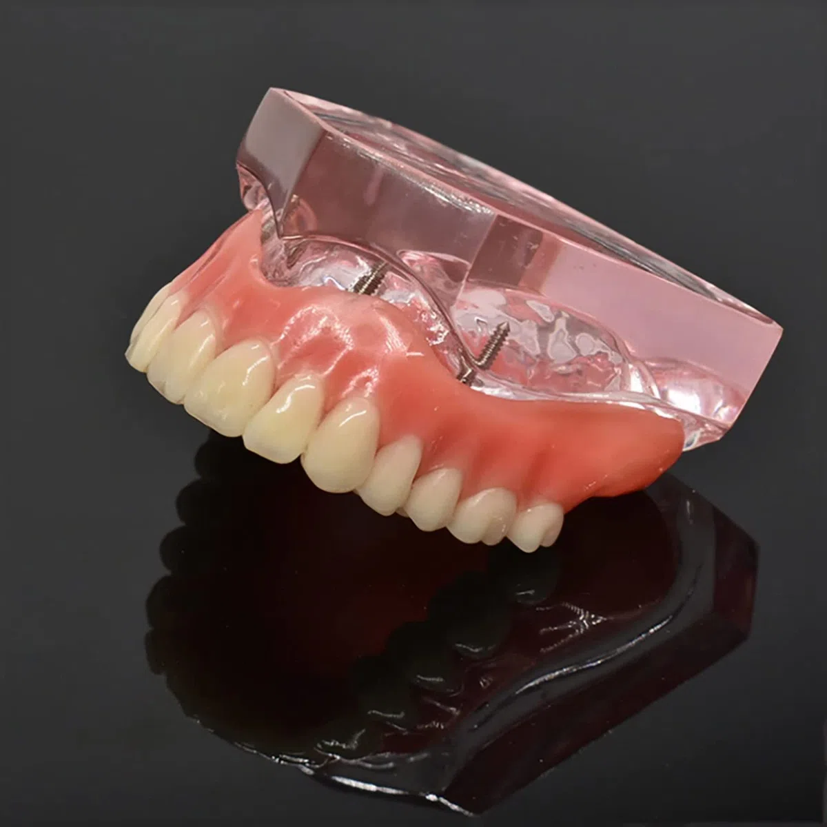 Standardowy model zębów, wyjmowana proteza Overdenture przezroczysty model odbudowy stomatologicznej dla stomatologii, edukacji i nauki.