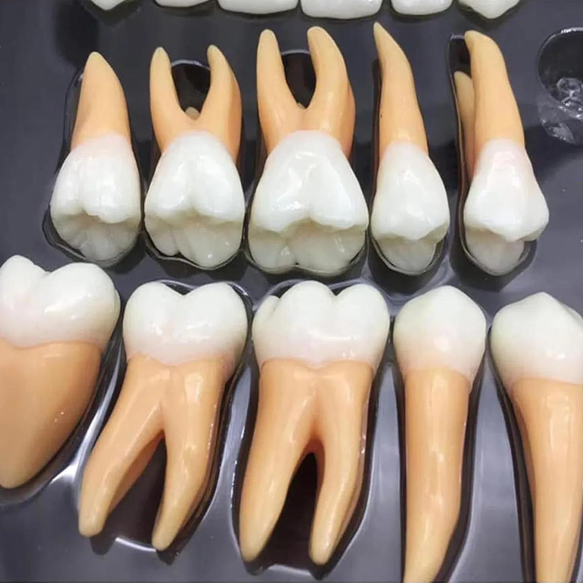 Zestaw modeli powiększonych zębów dentystycznych z etui do przechowywania, narzędzie edukacyjne dla dentystów i studentów