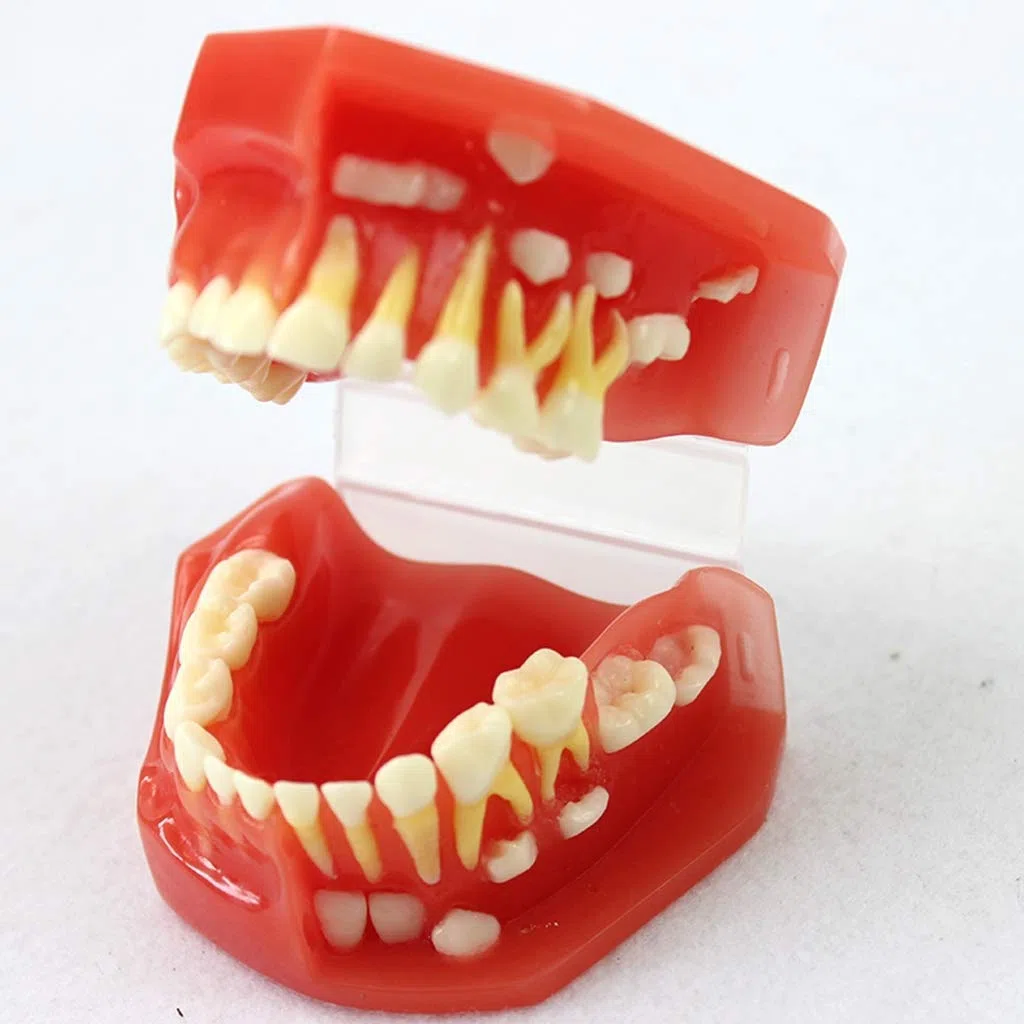 Model zębów do edukacji, model zębów dentystycznych - model zębów liściastych zębów dla dzieci, model higieny jamy ustnej dla entysty narzędzie do nauki nauki nauki