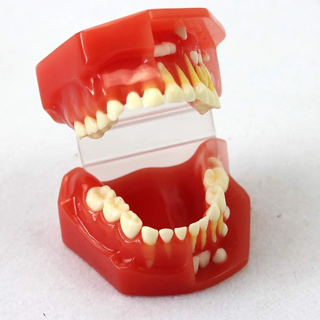 Model zębów do edukacji, model zębów dentystycznych - model zębów liściastych zębów dla dzieci, model higieny jamy ustnej dla entysty narzędzie do nauki nauki nauki