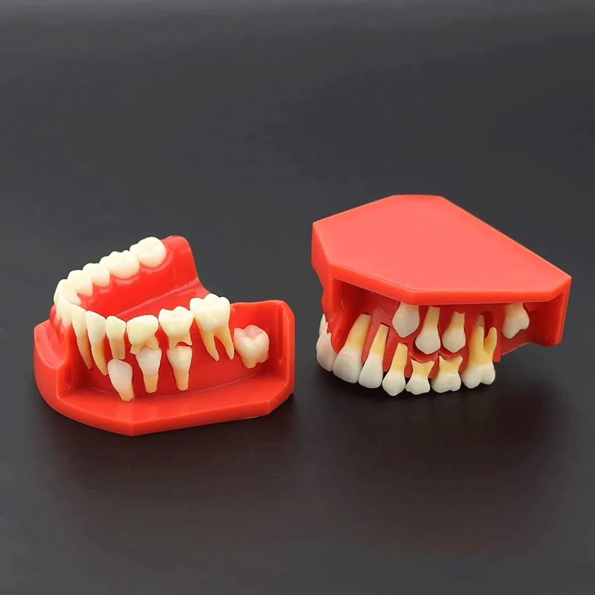 Zęby Dentystyczne Model Nauczania, Choroby Zębów Zdejmowane Zęby Model Demonstracyjny Zębów 9-12 Lat Dziecko Model Pielęgnacji Zębów Dentystycznych