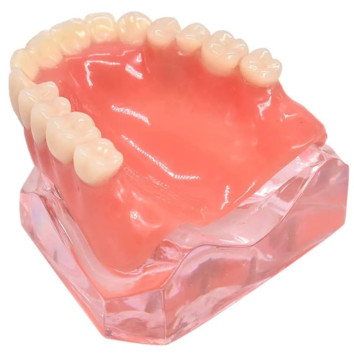 Standardowy model zębów, wyjmowana proteza Overdenture przezroczysty model odbudowy stomatologicznej dla stomatologii, edukacji i nauki.