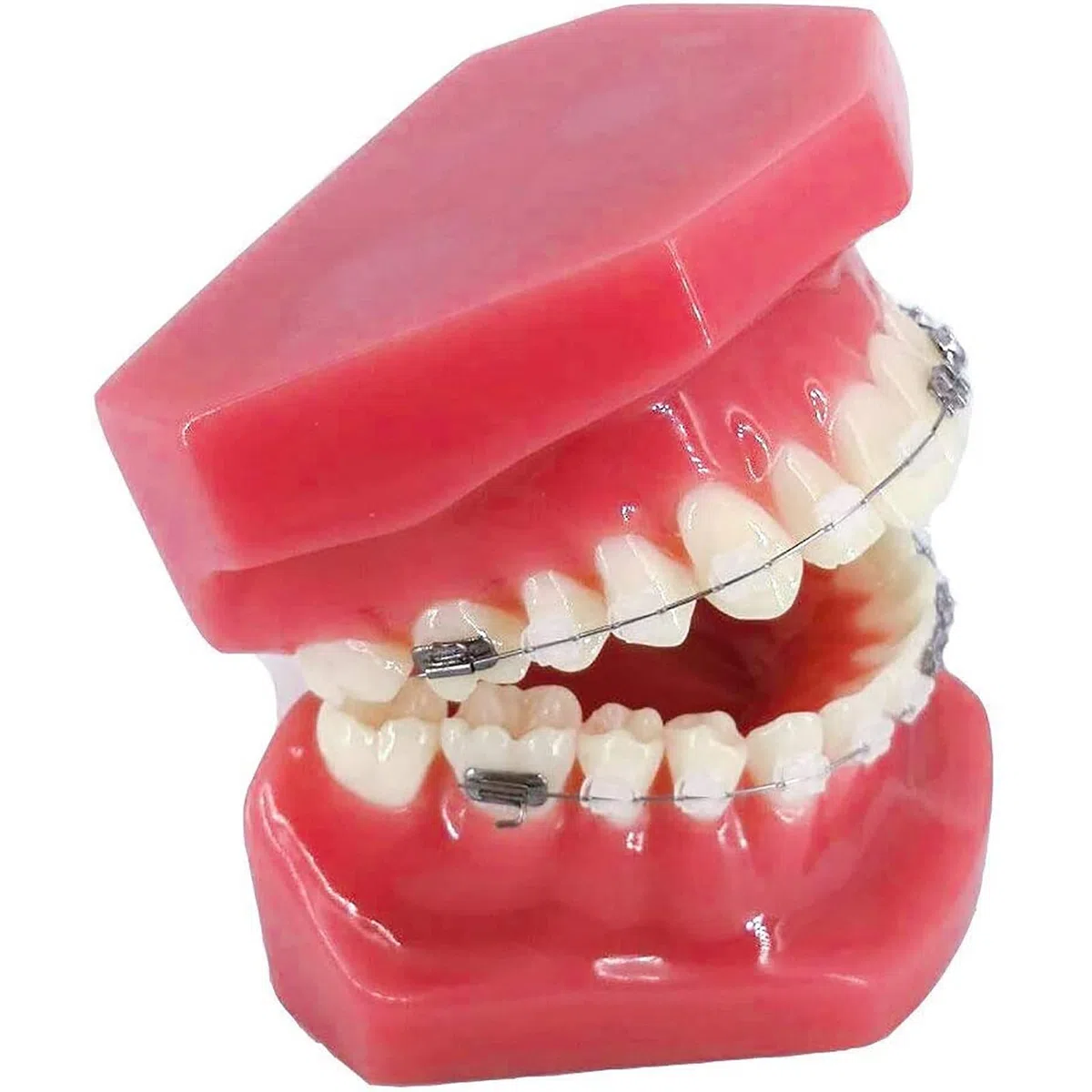 Model ortodontyczny zębów z metalowymi i ceramicznymi zamkami Modele demonstracyjne dla stomatologa do komunikacji z pacjentami.