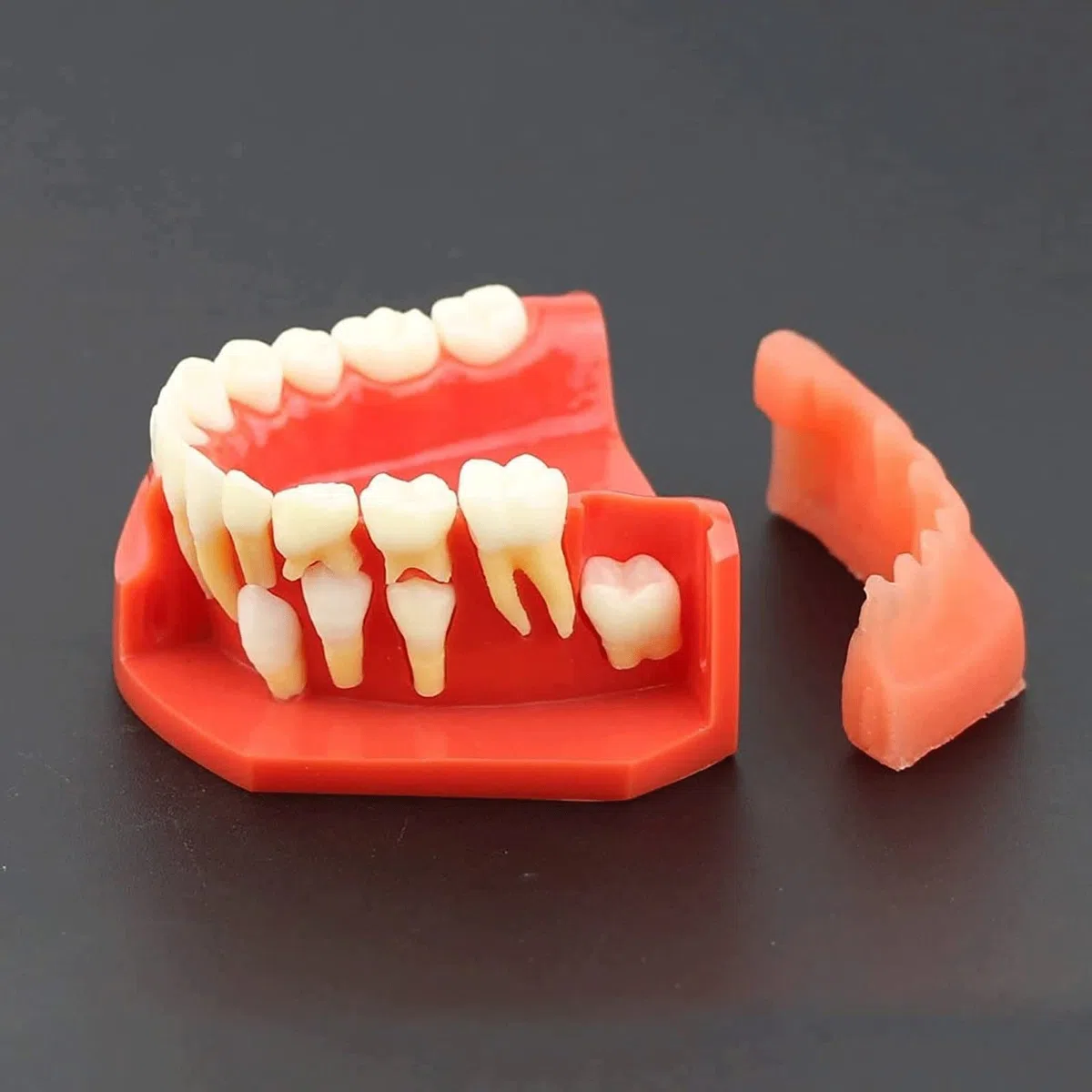 Zęby Dentystyczne Model Nauczania, Choroby Zębów Zdejmowane Zęby Model Demonstracyjny Zębów 9-12 Lat Dziecko Model Pielęgnacji Zębów Dentystycznych