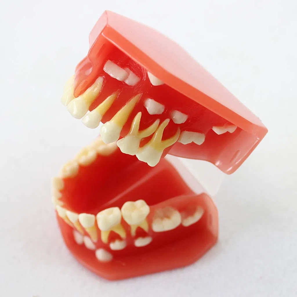 Model zębów do edukacji, model zębów dentystycznych - model zębów liściastych zębów dla dzieci, model higieny jamy ustnej dla entysty narzędzie do nauki nauki nauki
