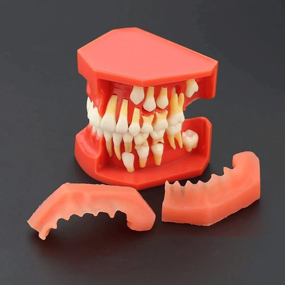 Zęby Dentystyczne Model Nauczania, Choroby Zębów Zdejmowane Zęby Model Demonstracyjny Zębów 9-12 Lat Dziecko Model Pielęgnacji Zębów Dentystycznych