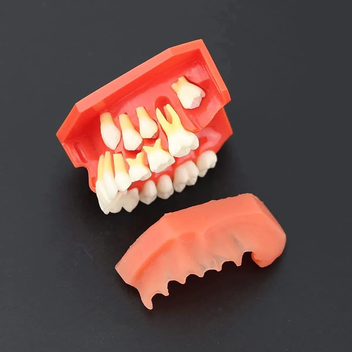 Zęby Dentystyczne Model Nauczania, Choroby Zębów Zdejmowane Zęby Model Demonstracyjny Zębów 9-12 Lat Dziecko Model Pielęgnacji Zębów Dentystycznych