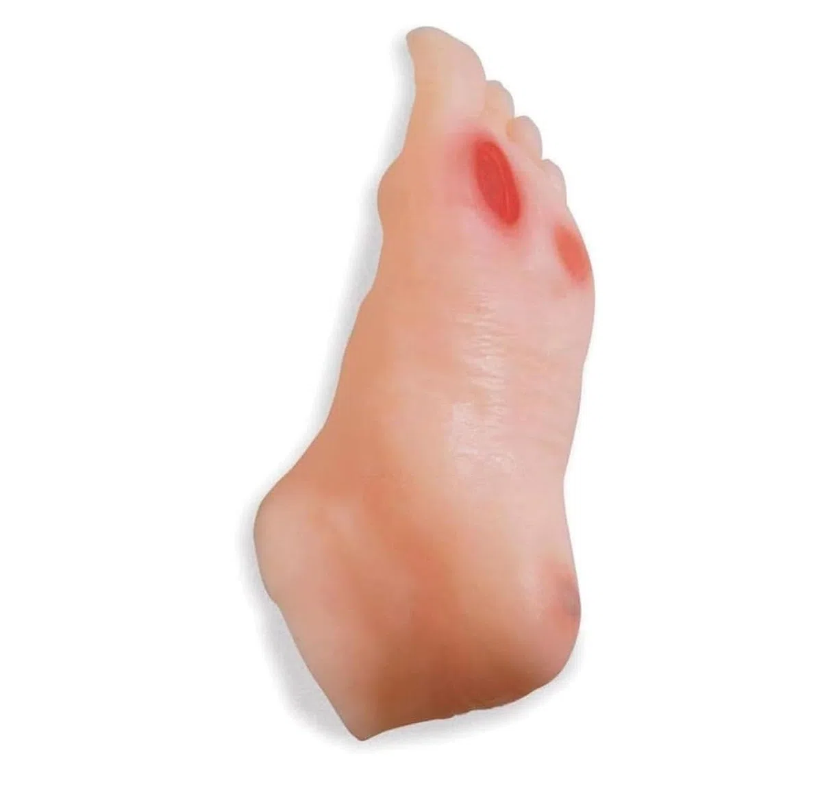 Model stopy cukrzycowej, model pielęgniarstwa geriatrycznego – zawiera 3 owrzodzenia, model stopy cukrzycowej, model demonstracyjny do celów medycznych dla studentów anatomii, fizjologii