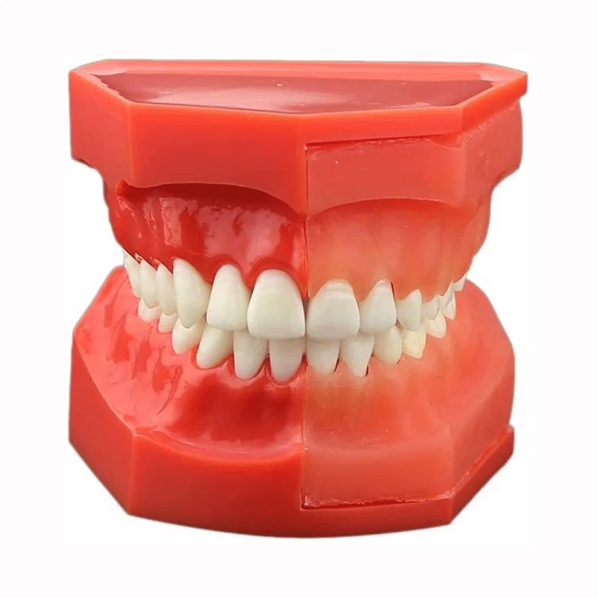 Zęby Dentystyczne Model Nauczania, Choroby Zębów Zdejmowane Zęby Model Demonstracyjny Zębów 9-12 Lat Dziecko Model Pielęgnacji Zębów Dentystycznych